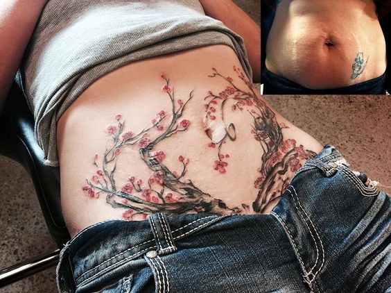 cherry blossom tree tattoo to cover up belly scars