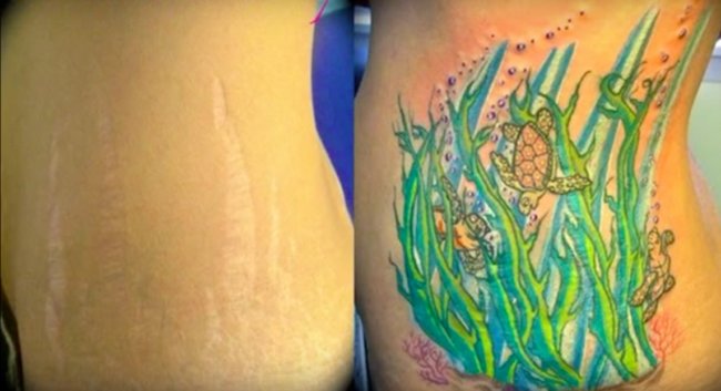 sea underwater world tattoo over stretch marks