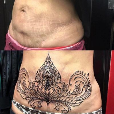 tummy tuck scar tattoo cover up ideas
