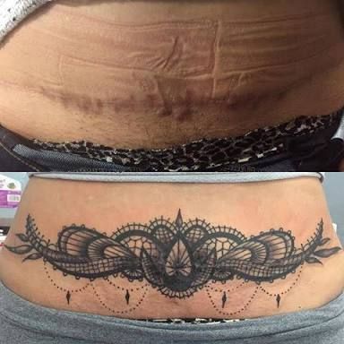 tummy tuck scar cover up chandeliers tattoo